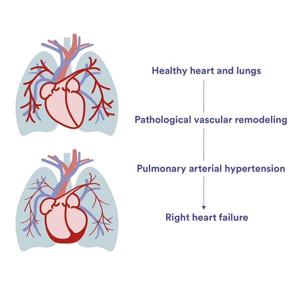 healthy-heart-and-lungs